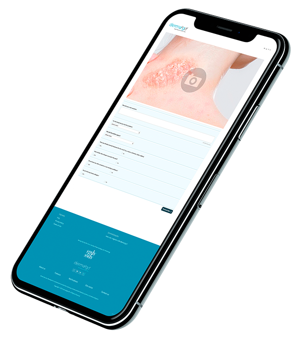 Smartphone mit einem online Fragebogen für eine Online-Konsultation bei einem Hautarzt